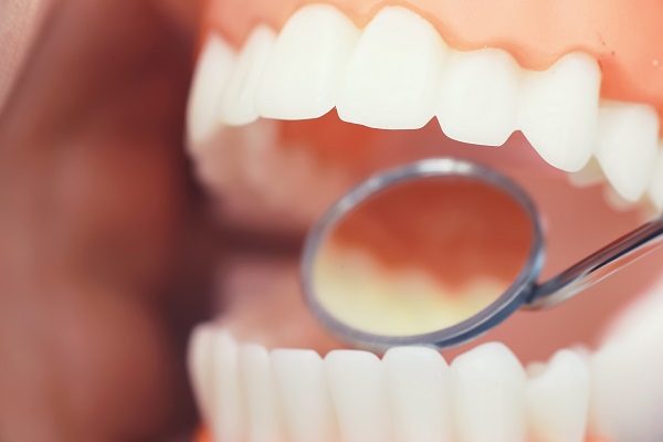Why You Need A Dental Check Up